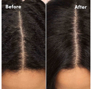 Mizani Scalp Care Calming Scalp Lotion