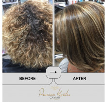 Premium Keratin Caviar Brazilian Keratin Treatment Kit (Activ Shampoo & Revitaliz System) - 1000ml