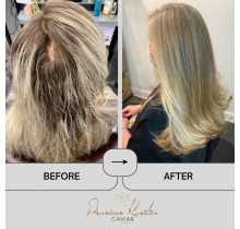 Premium Keratin Caviar Brazilian Keratin Treatment Kit (Activ Shampoo & Revitaliz System) - 150ml
