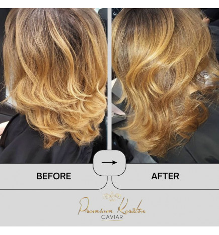 Premium Keratin Caviar Nano Hair Vitamin pack of 3