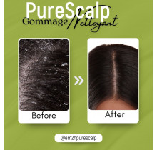 Em2h PureScalp Cleansing scalp Scrub