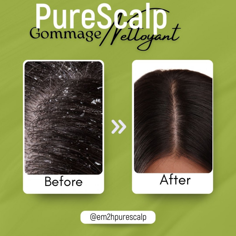 Em2h PureScalp Cleansing scalp Scrub