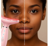 Rafète Skin - skin rejuvenation device, Even and Soothed Skin Rafète Skin - skin rejuvenation device, Even and Soothed Skin