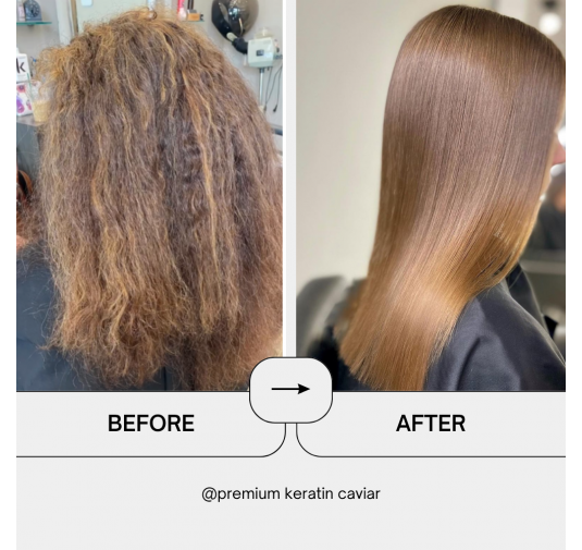 Premium Keratin Caviar - Revitaliz System - 500ml